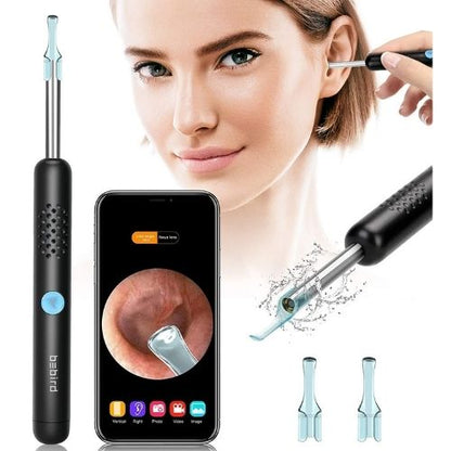 Smart Visual Ear Wax Remover with Camera – HD WiFi Ear Cleaner Otoscope with LED Lights & App for iPhone/Android